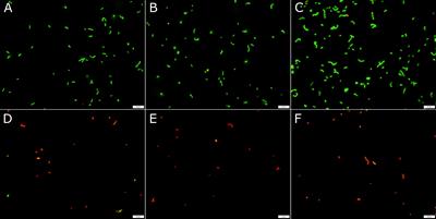 Antimicrobial Activity of Phytic Acid: An Emerging Agent in Endodontics